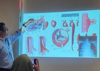 Kecepatan Menjadi Kunci Penyelamatan Nyawa pada Penanganan Penyakit Aorta Kompleks di Era Modern